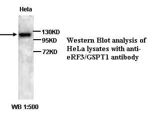 Anti-CTGF