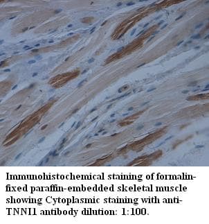 Anti-TNNI1