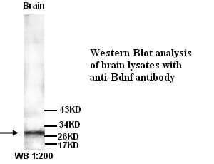 Anti-Bdnf