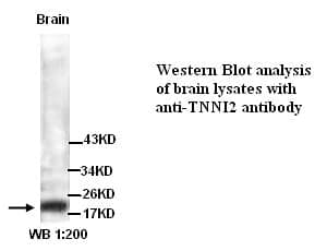 Anti- TNNI2