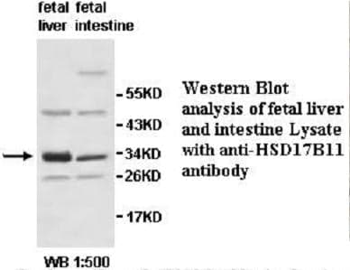 Anti-HSD17B11