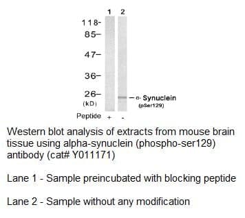 Anti-&szlig;-Synuclein (Phospho-Ser129)