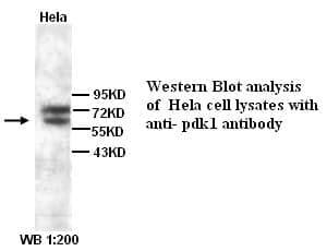 Anti-PDK1
