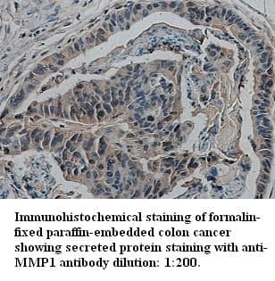Anti-MMP1