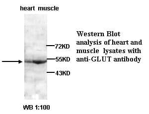 Anti-GLUT1