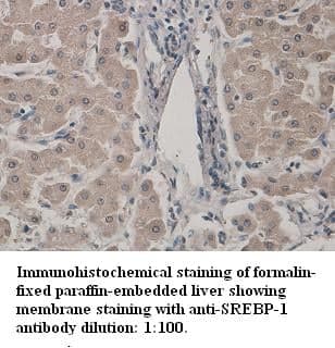 Anti-SREBP-1