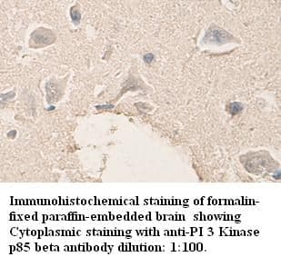 Anti-PI 3 Kinase p85 beta