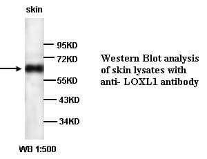 Anti-LOXL1