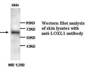 LOXL1