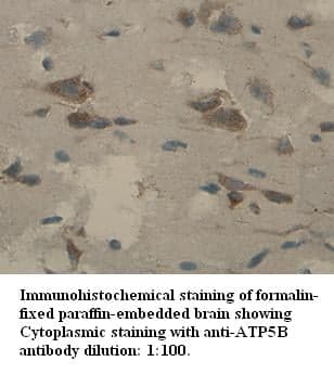 Anti-ATP5B