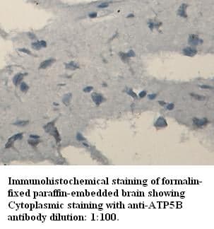 Anti-ATP6B