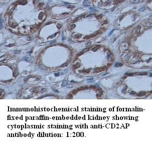 Anti-CD2AP