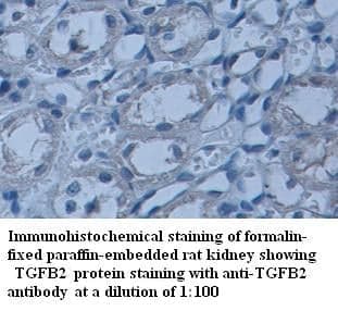 Anti-TGFB2