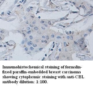 Anti-CBL
