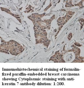 Anti-keratin 7/Cytokeratin 7