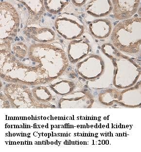 Anti-Vimentin