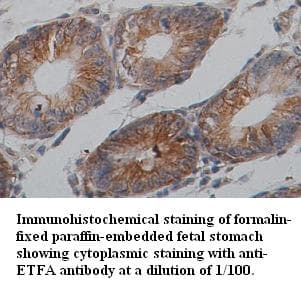 Anti-ETFA