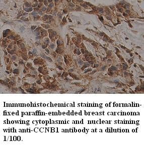 Anti-CCNB1