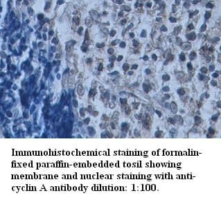 Anti-cyclin A