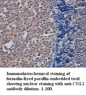 Anti-CUL2