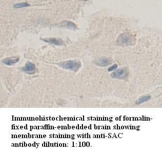 Anti-SAC