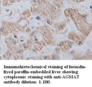 Anti-AGMAT