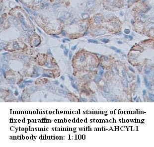 Anti-AHCYL1
