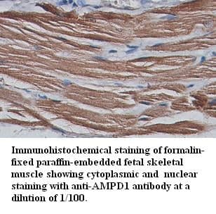 Anti-AMPD1