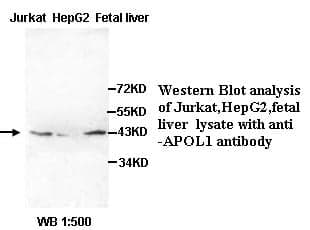 Anti-APOL1
