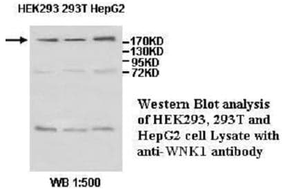 Anti-WNK1