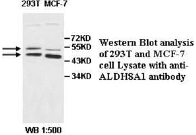 Anti-ALDH8A1
