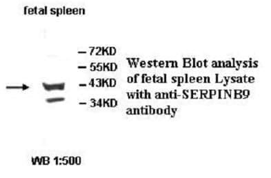 Anti-SERPINB9