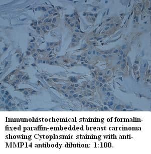 Anti-MMP14