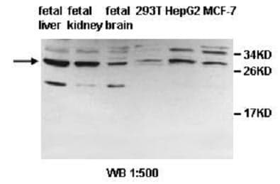 Anti-PDCL2