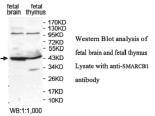Anti-SMARCB1