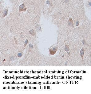 Anti-CNTFR