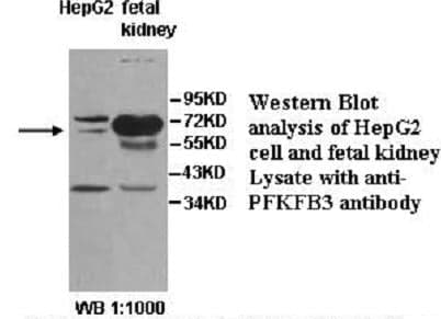 Anti-PFKFB3