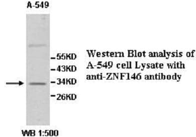 Anti-ZNF146