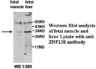 Anti-ZNF138