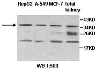 Anti-ZNF101