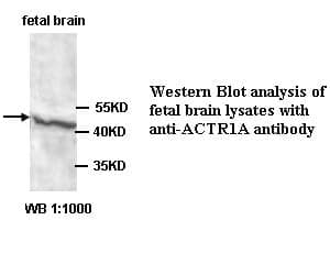 Anti-ACTR1A