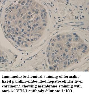 Anti-ACVRL1