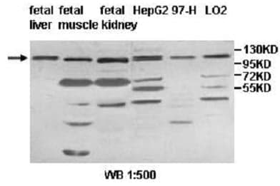 Anti-IMPG1