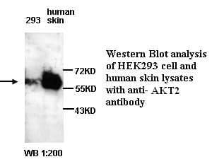 Anti-Akt2