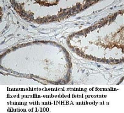 Anti-INHBA