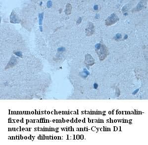 Anti-Cyclin D1