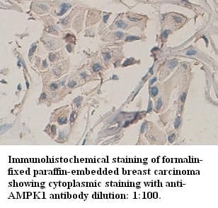 Anti-AMPK1