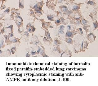 Anti-AMPK beta 1