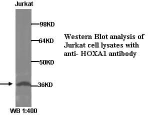 Anti-HOXA1