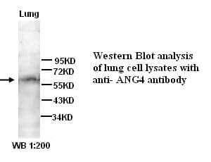 Anti-angiopoietin 4